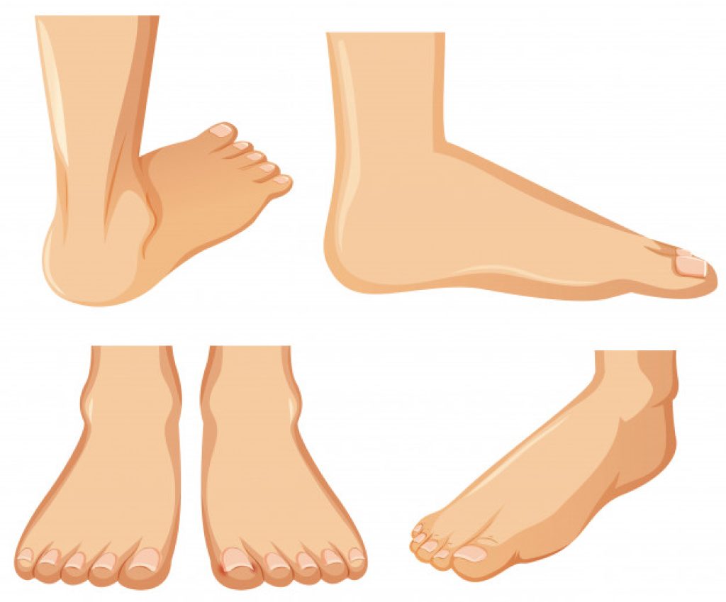 bunion