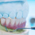 What Is Family Dental Care?